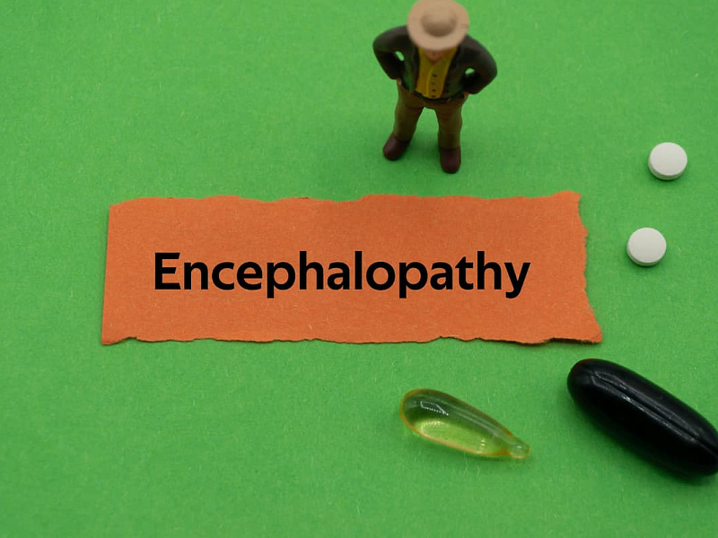 Симптомы печеночной энцефалопатии